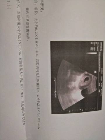 journal_insert_pic_1023319347