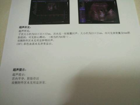 journal_insert_pic_1023441520