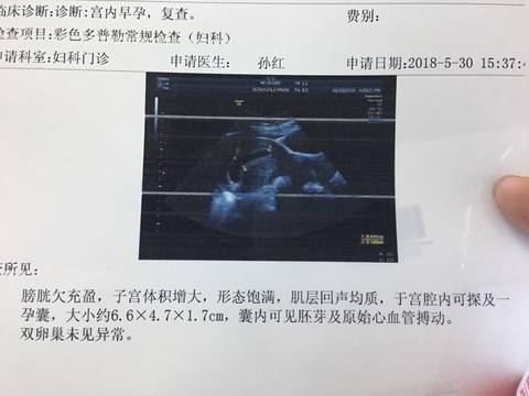 journal_insert_pic_1023820283