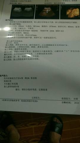 journal_insert_pic_1023771004