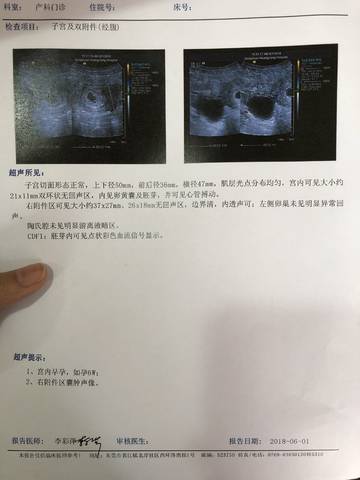 journal_insert_pic_1024728736