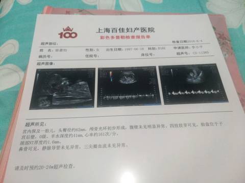 journal_insert_pic_1027529786