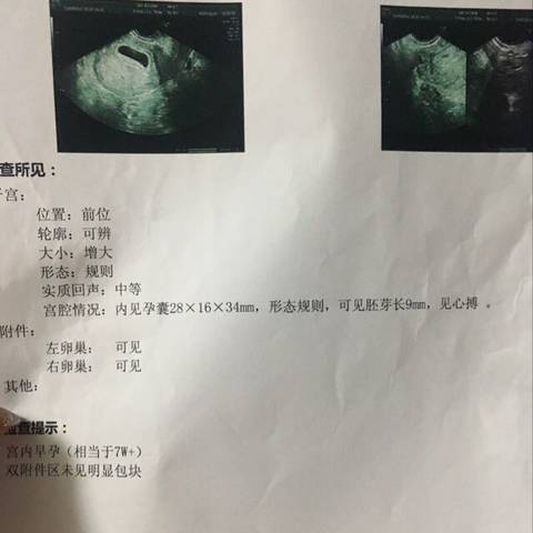 journal_insert_pic_1028372732