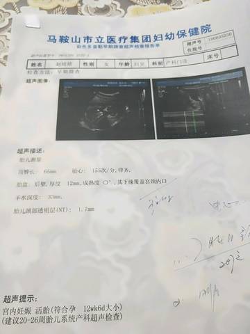 journal_insert_pic_1027957857