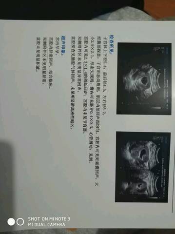 journal_insert_pic_1028734122