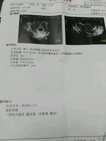journal_insert_pic_1029095980