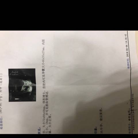 journal_insert_pic_1029257994
