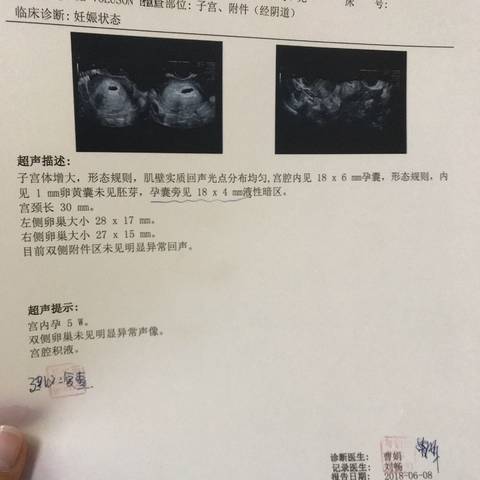 journal_insert_pic_1030536913