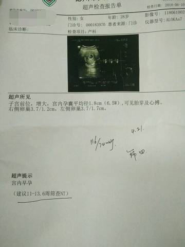 journal_insert_pic_1031515142