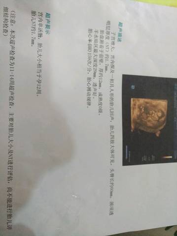 journal_insert_pic_1032499795