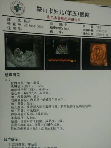 journal_insert_pic_1032523792
