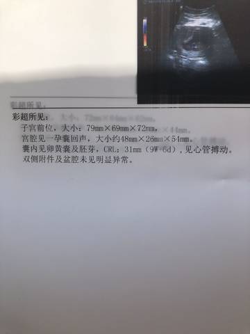 journal_insert_pic_1033312378