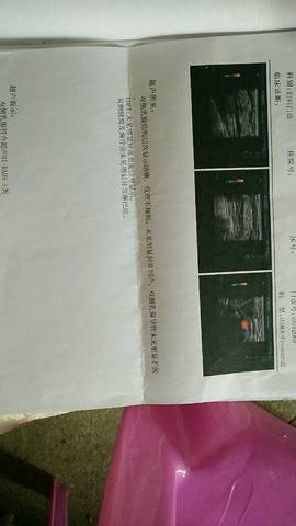 journal_insert_pic_1034175182