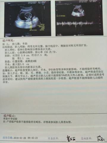 journal_insert_pic_1033818710