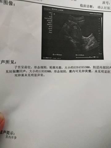 journal_insert_pic_1036959515