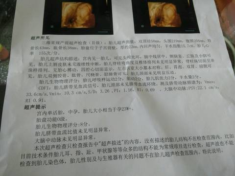 journal_insert_pic_1038891575