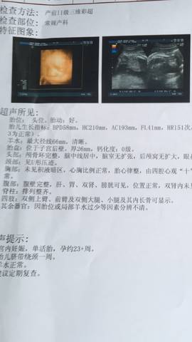 journal_insert_pic_1039647629