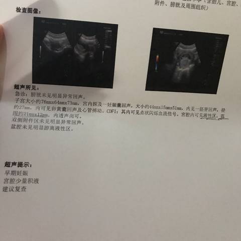 journal_insert_pic_1039450913