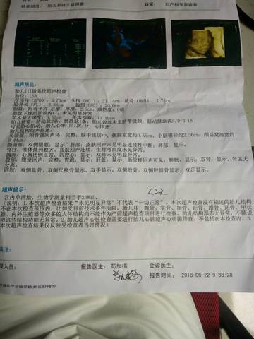 journal_insert_pic_1040543390