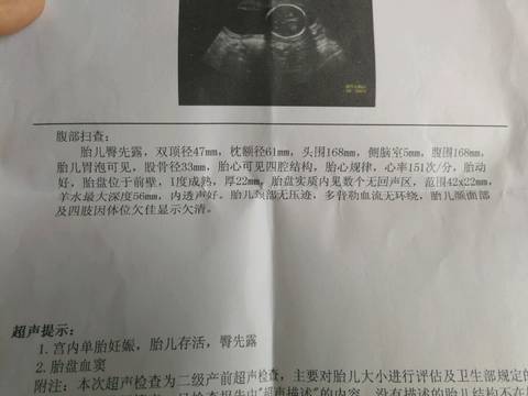 journal_insert_pic_1041486374