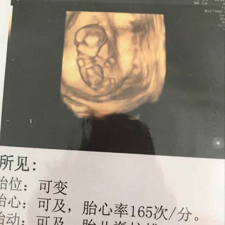 NT顺利通过，是否能判断男女？