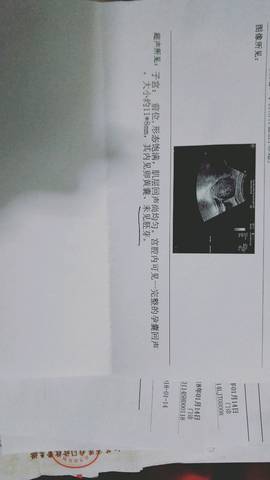 journal_insert_pic_1044013360