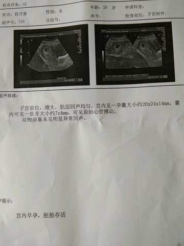 journal_insert_pic_1047115068