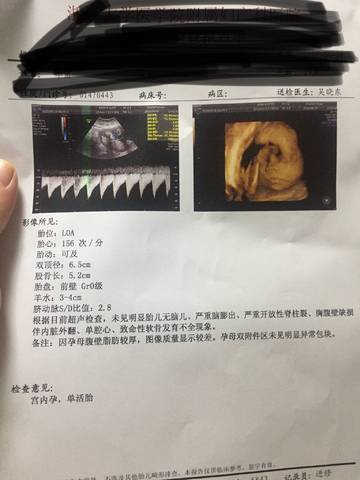journal_insert_pic_1047148632