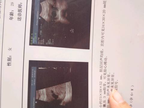 journal_insert_pic_1047174191