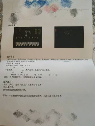 journal_insert_pic_1053808842