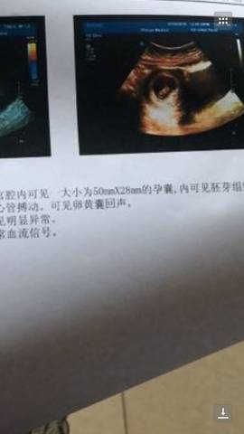 journal_insert_pic_1054371418