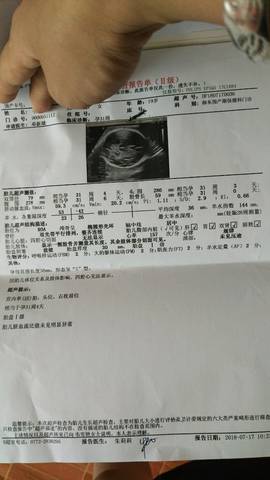 journal_insert_pic_1056253541