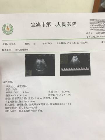 journal_insert_pic_1058543173