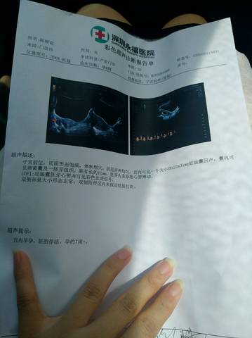 journal_insert_pic_1059742989