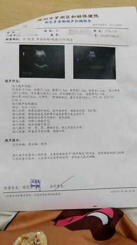 journal_insert_pic_1064216986