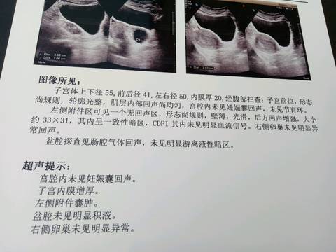 journal_insert_pic_1065774987