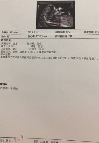 journal_insert_pic_1066334398