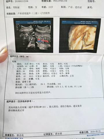 journal_insert_pic_1066232835