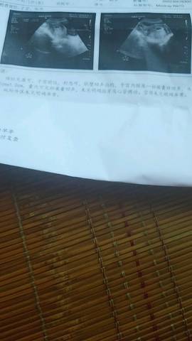 journal_insert_pic_1066988886