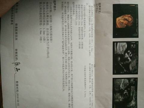 journal_insert_pic_1068174620