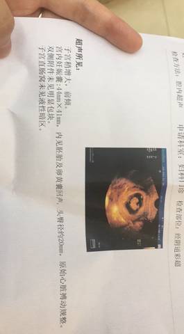journal_insert_pic_1069077656
