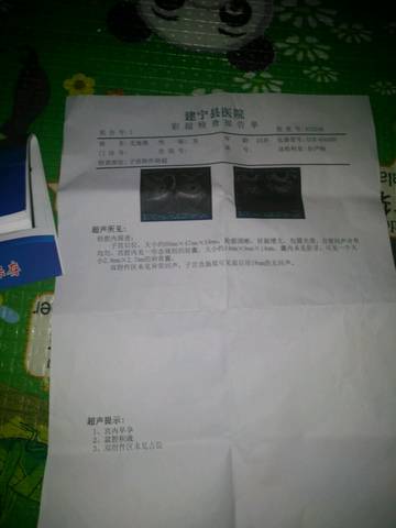 journal_insert_pic_1070332132