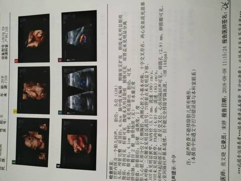journal_insert_pic_1070109980