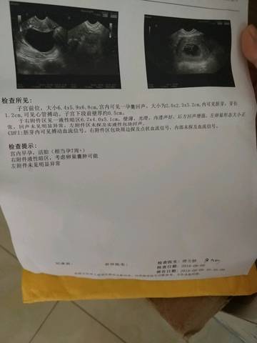journal_insert_pic_1070620875