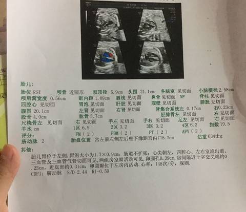 journal_insert_pic_1071479603