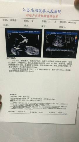 journal_insert_pic_1071158531