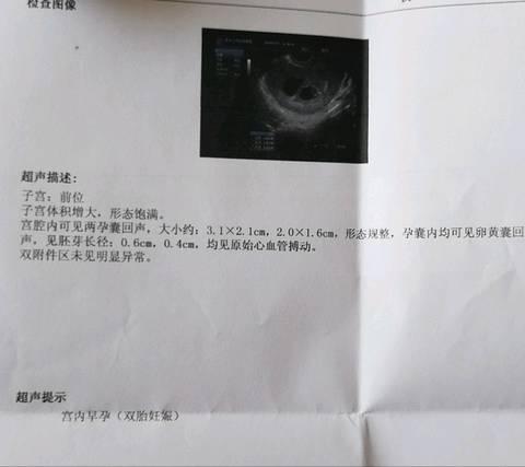 journal_insert_pic_1072214801