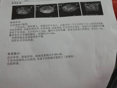 journal_insert_pic_1071842289