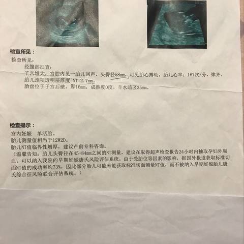 journal_insert_pic_1074061738
