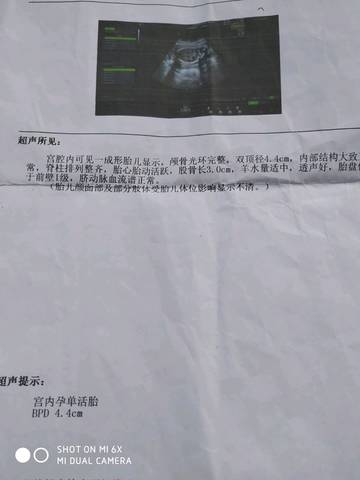journal_insert_pic_1074695662